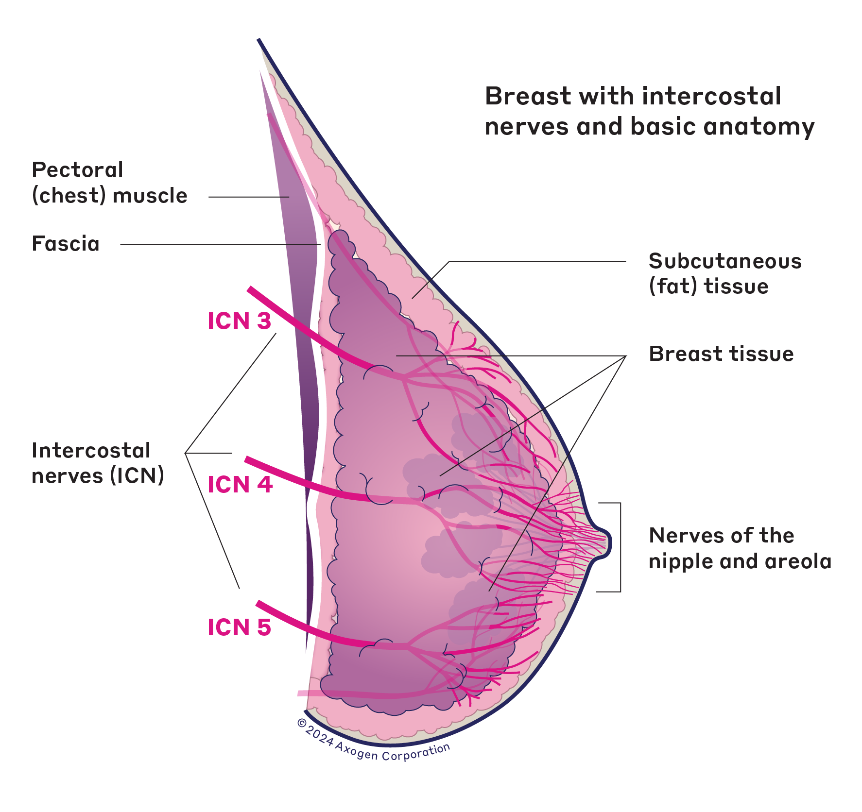 A side-view illustration of a right breast, with labels showing the intercostal nerves and other anatomy